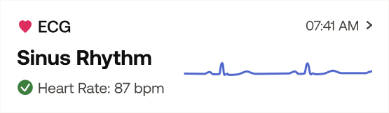Withings | ScanWatch Nova