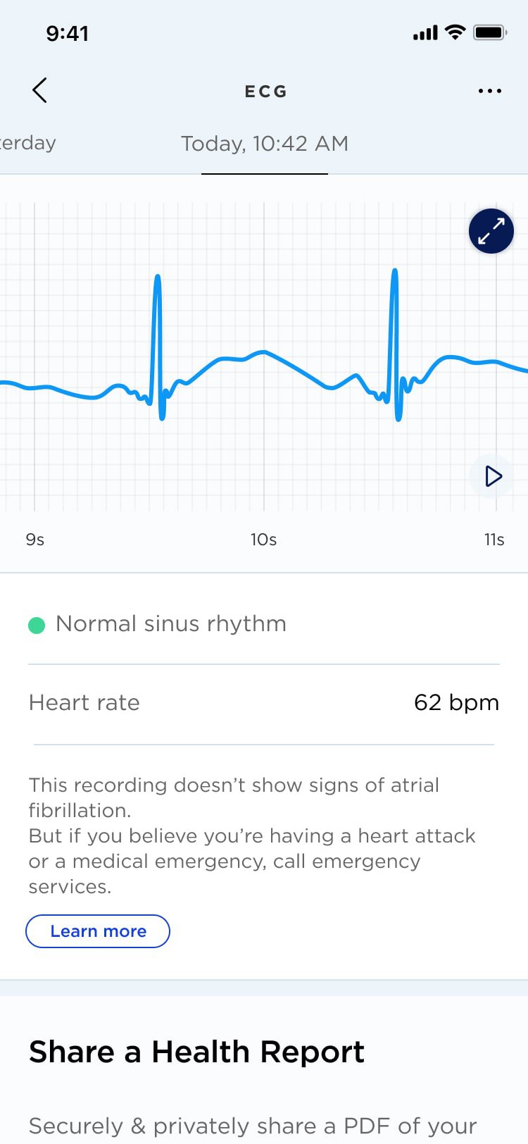 iPhone blood pressure peripheral head to head review: Withings verse  iHealth, medical perspective